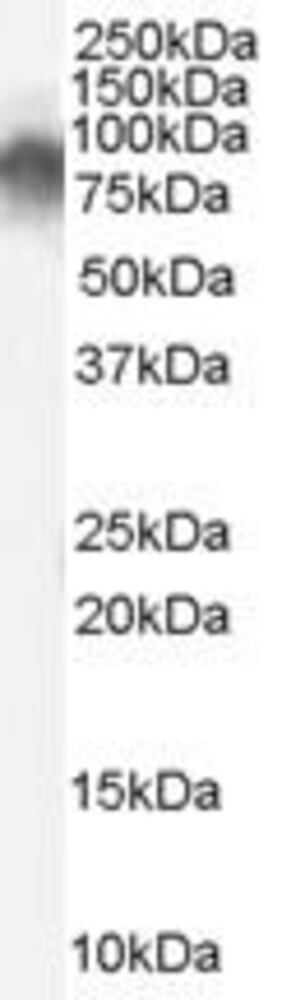 Anti-Radixin/RDX Antibody, 100 µg