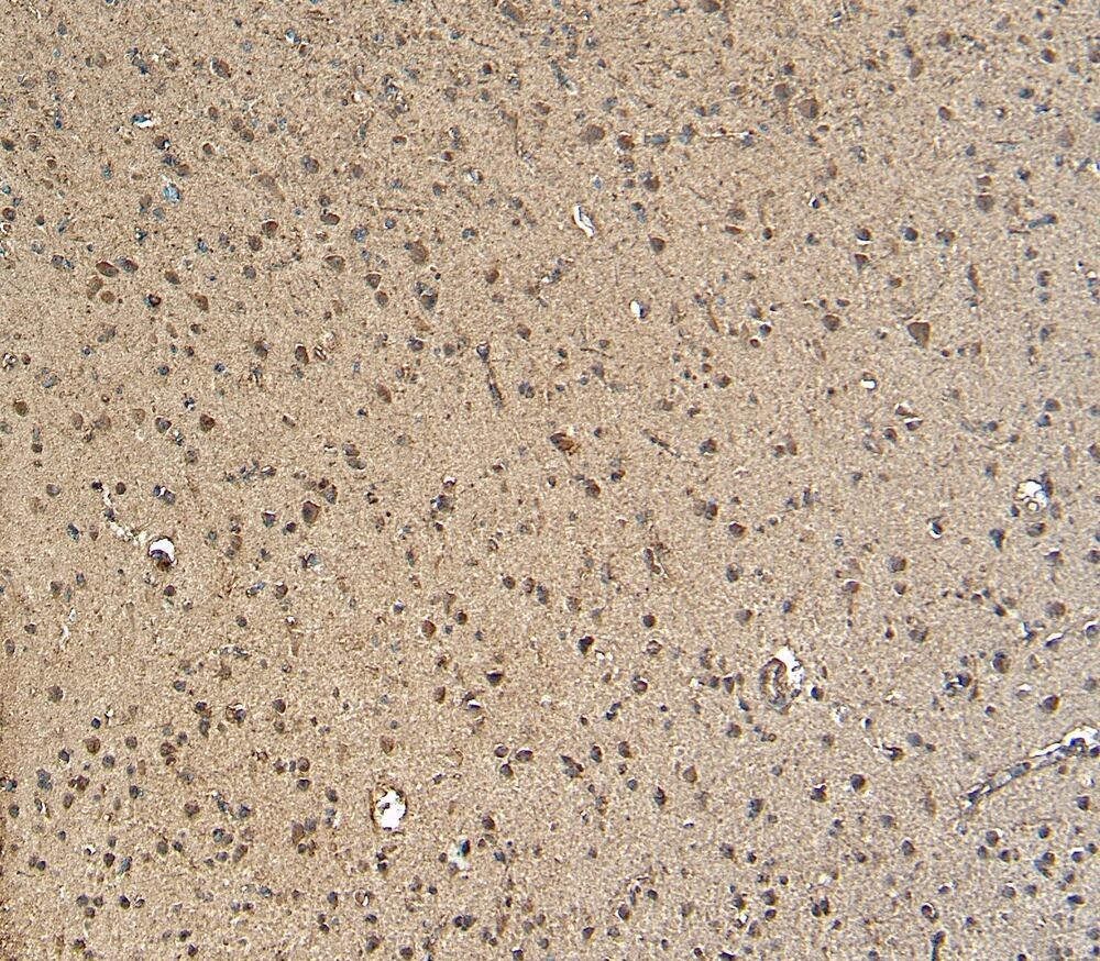 Anti-Gbx2 Antibody