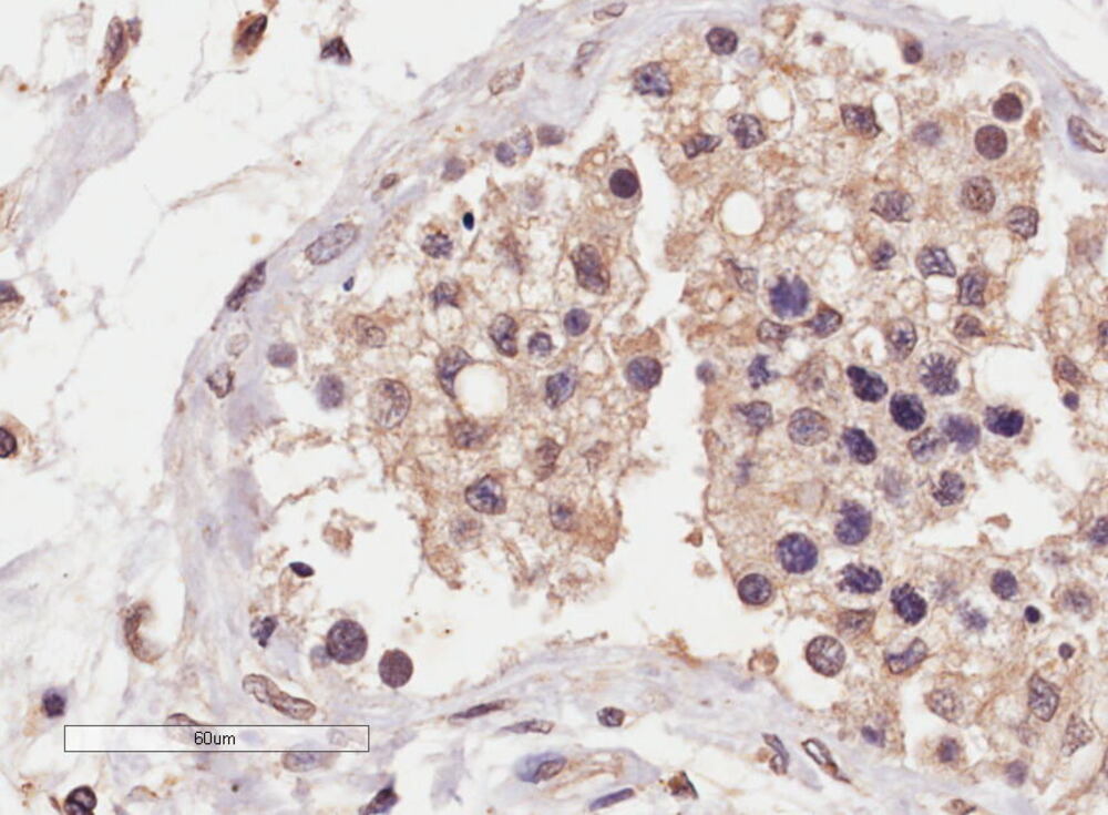 Anti-SLC22A16 Antibody, 100 µg