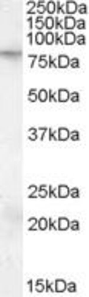 Anti-FMRP Antibody, 100 µg