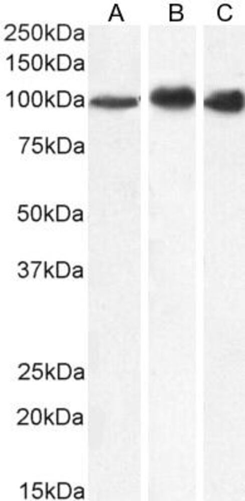 Anti-MTHFD1 Antibody, 100 µg