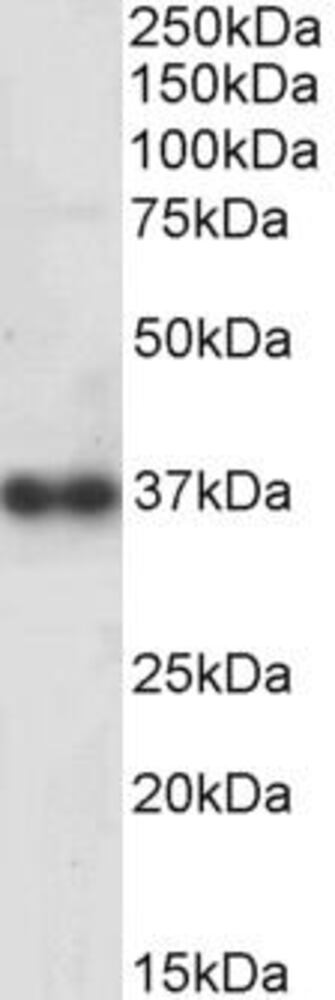 Anti-Cathepsin K Antibody, 100 µg