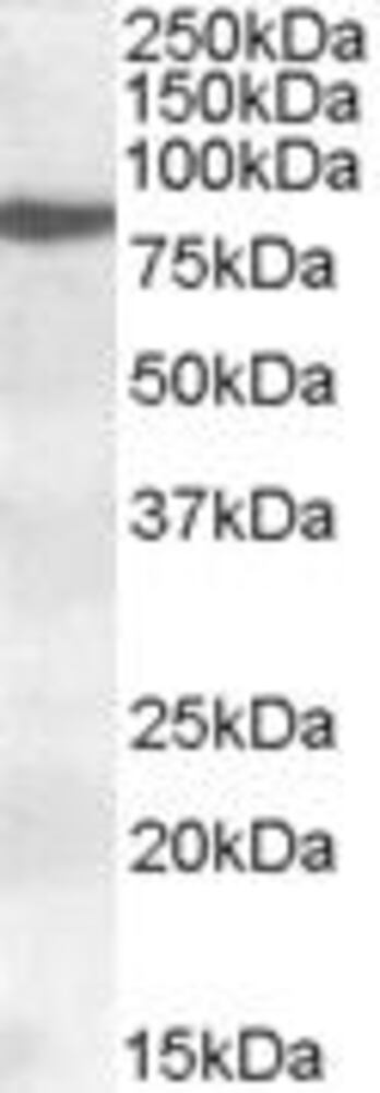 Anti-15 Lipoxygenase 1 Antibody, 100 µg
