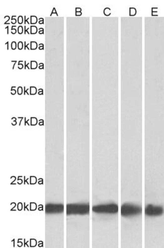 Anti-Ferritin Light Chain Antibody, 100 µg