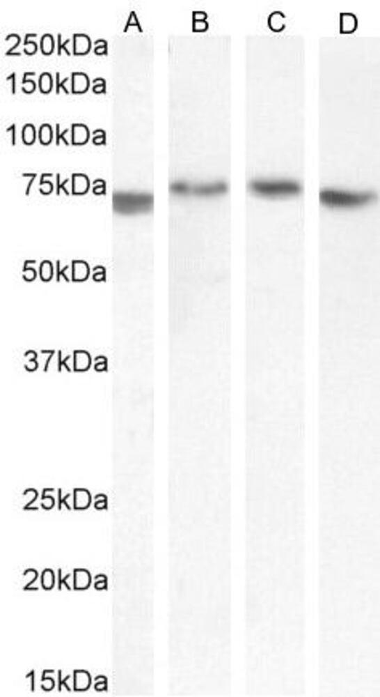 Anti-TGFBI Antibody, 100 µg
