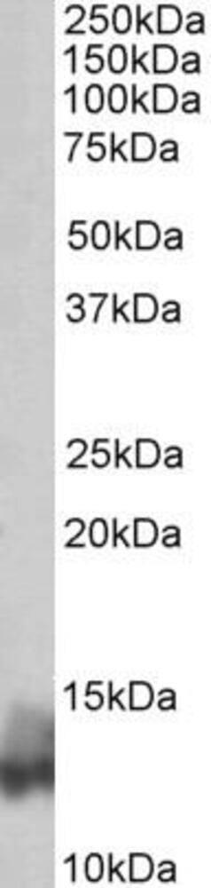 Anti-Phospholamban Antibody