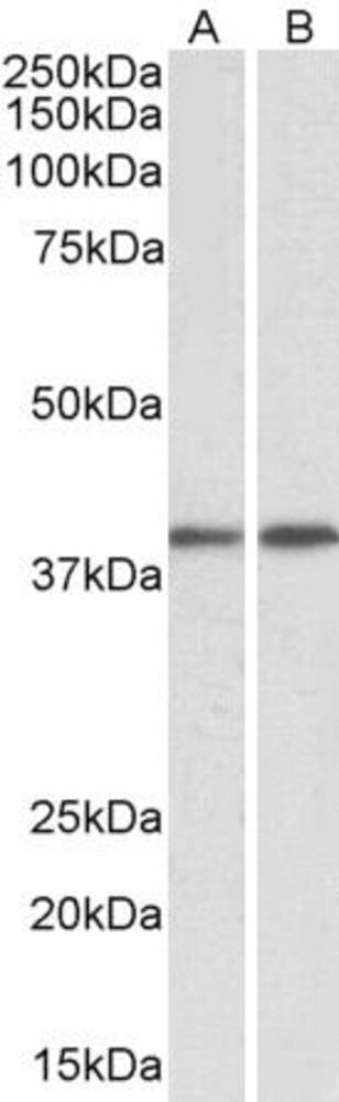 Anti-GNAQ Antibody, 100 µg