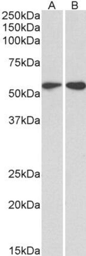 Anti-Vimentin Antibody, 100 µg