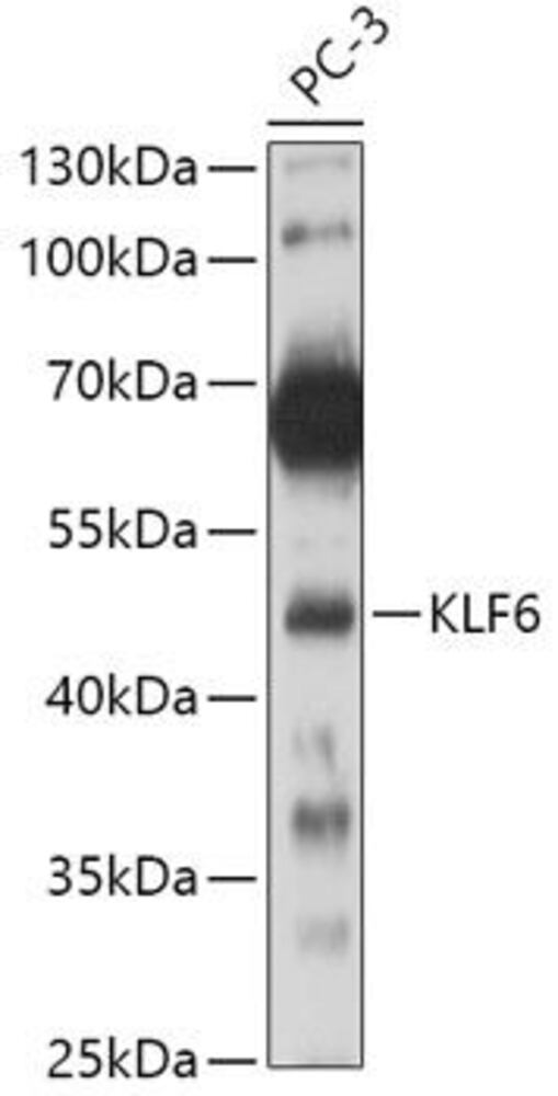 Anti-KLF6 Antibody, 100 µl
