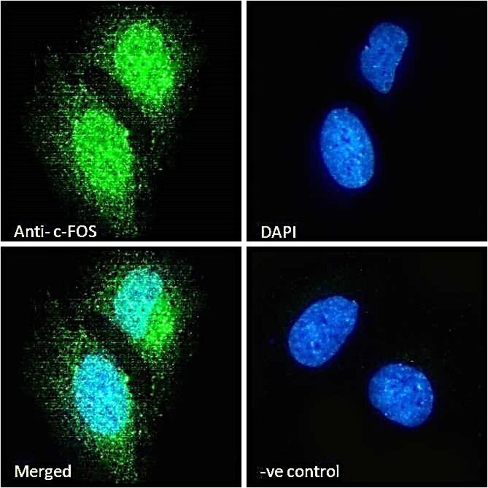Anti-c-Fos Antibody, 100 µg