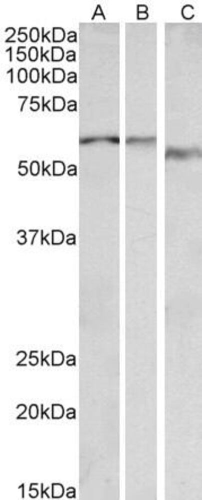Anti-ADRA1B Antibody, 100 µg