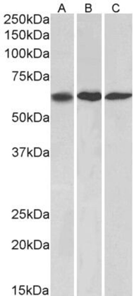 Anti-MMP14 Antibody, 100 µg