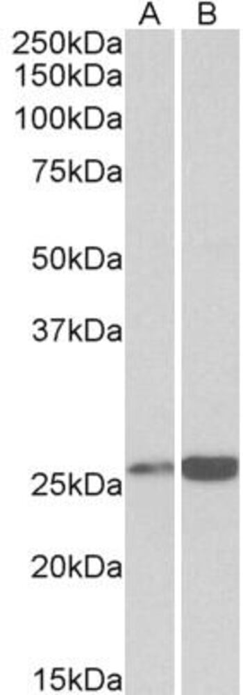 Anti-Peroxiredoxin 6 Antibody, 100 µg