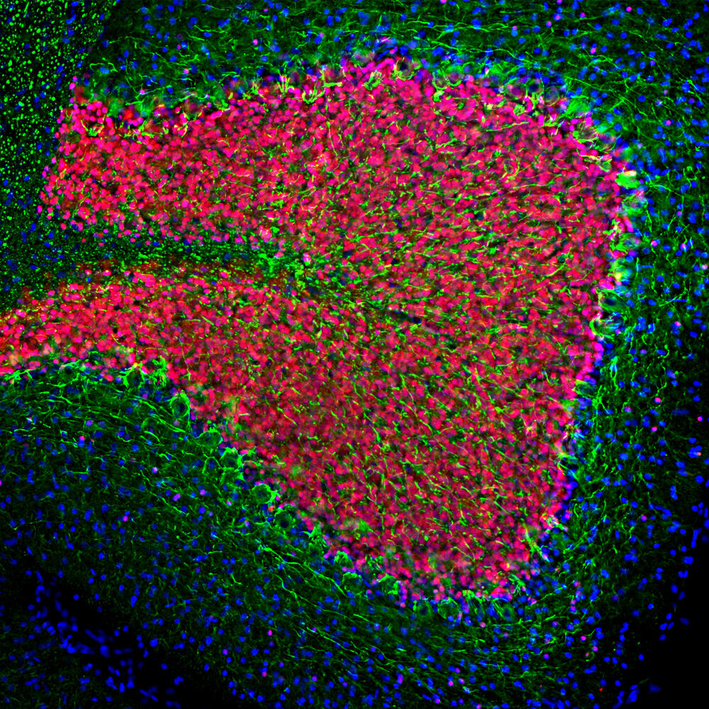 Anti-NF-L Antibody