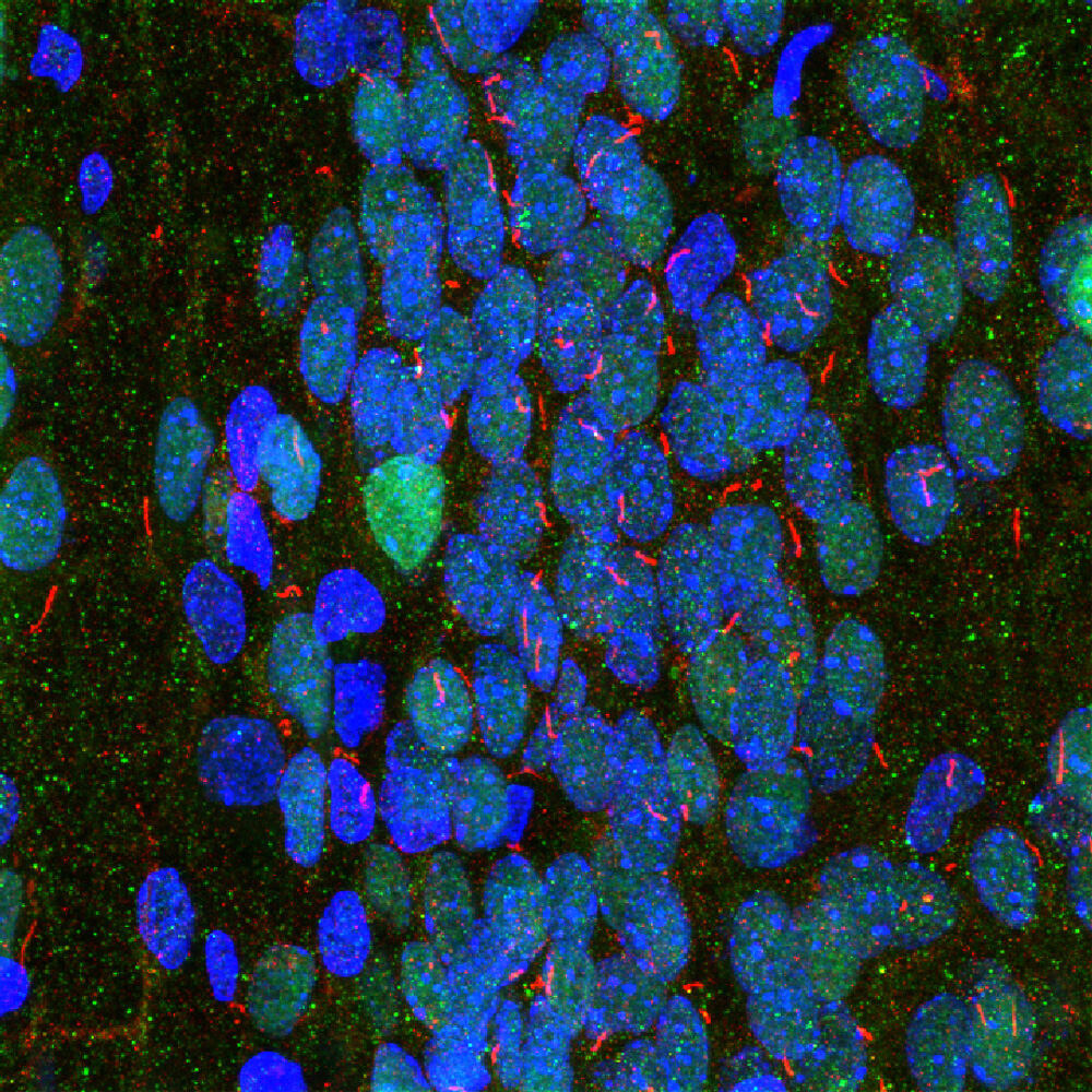Anti-Adenylate Cyclase 3 Antibody