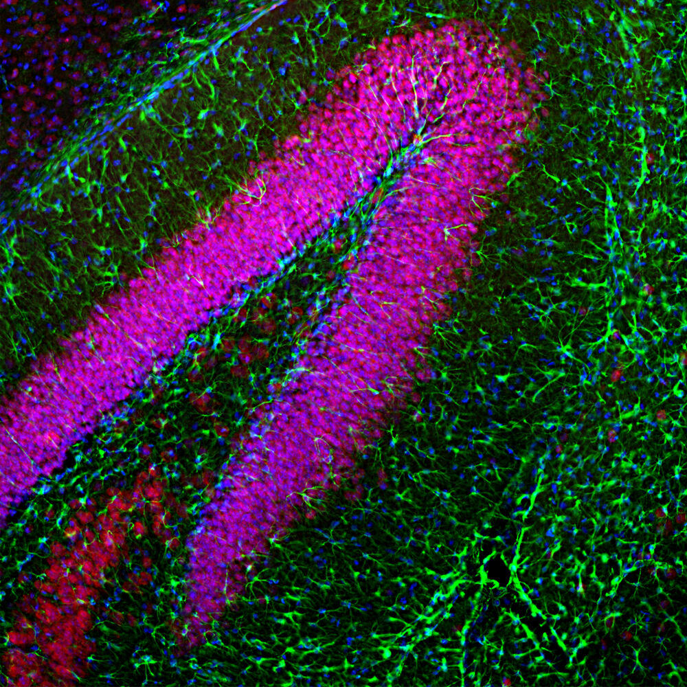 Anti-GFAP Antibody