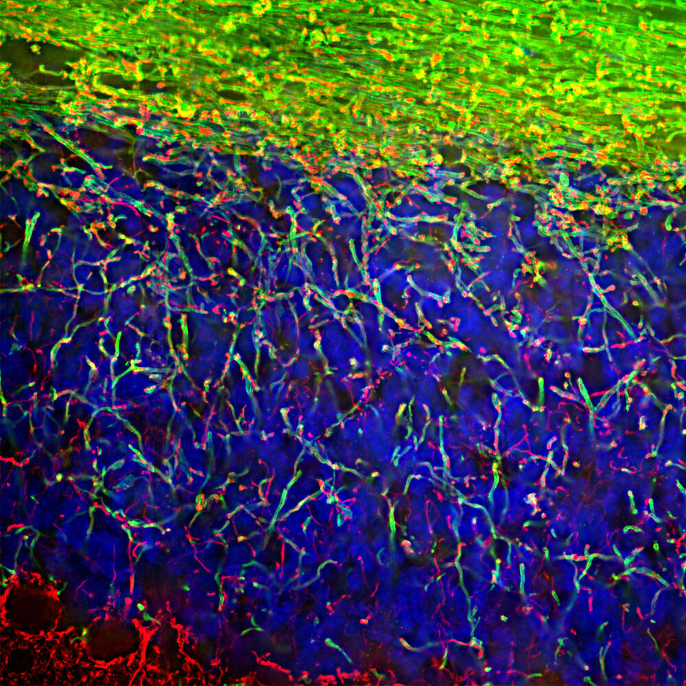 Anti-Myelin Basic Protein Antibody