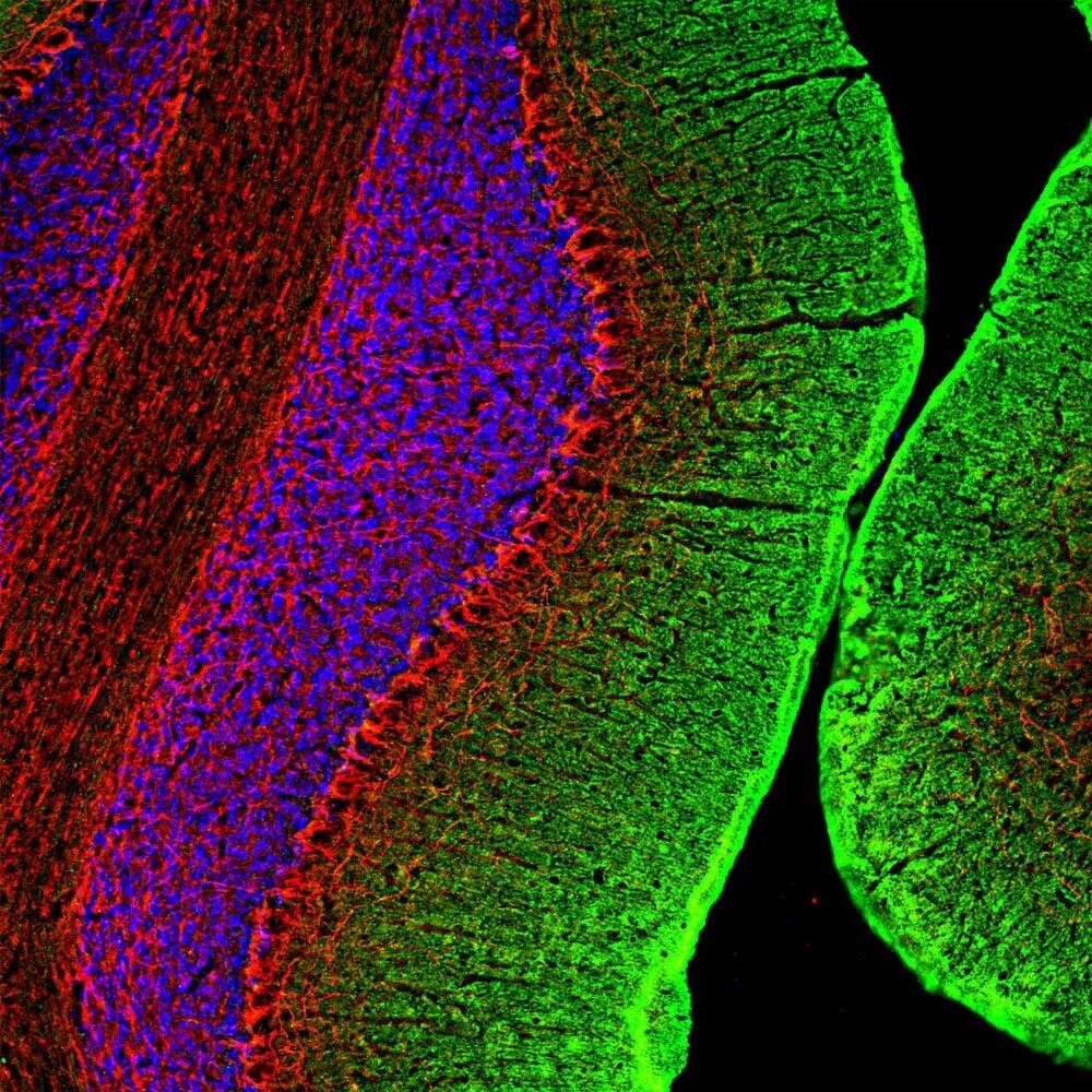 Anti-NF-M Antibody