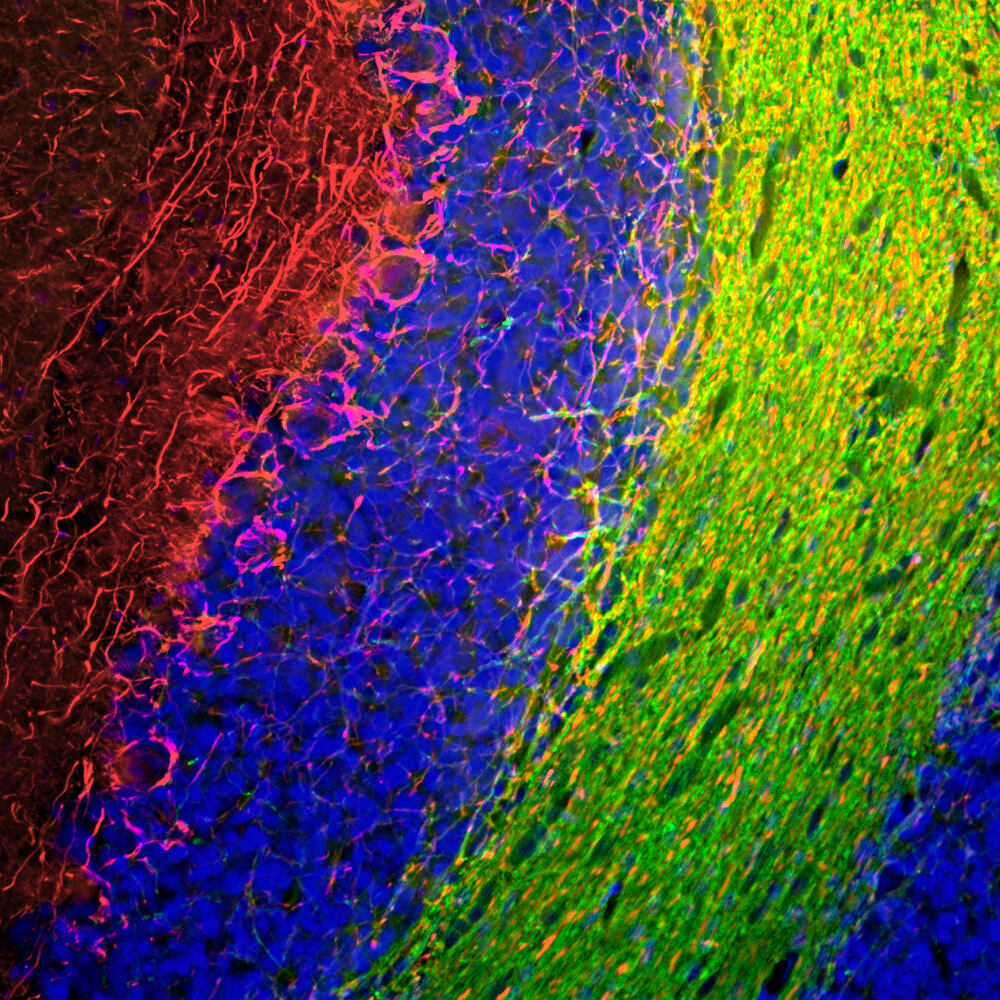 Anti-NF-M Antibody