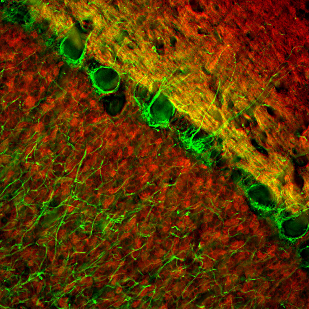 Anti-Visinin Like Protein 1 Antibody