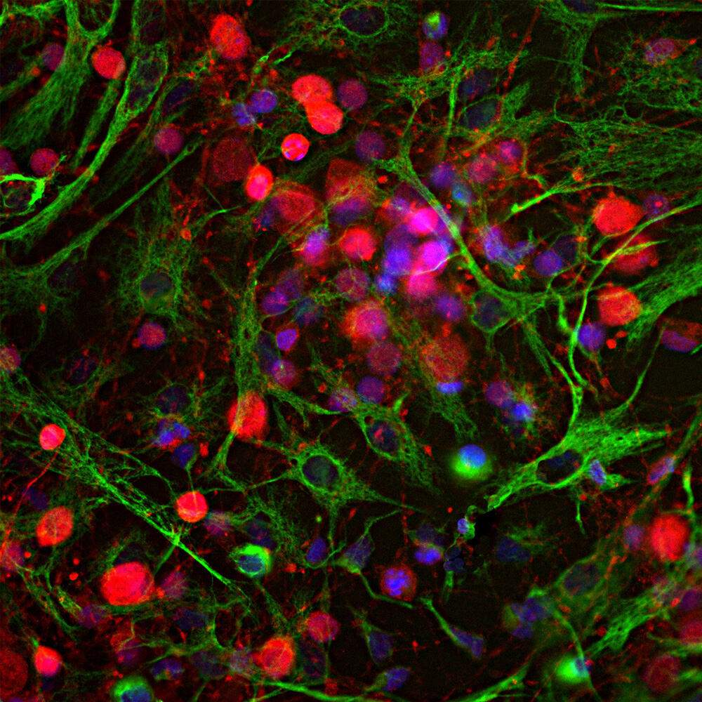 Anti-UCHL1 Antibody