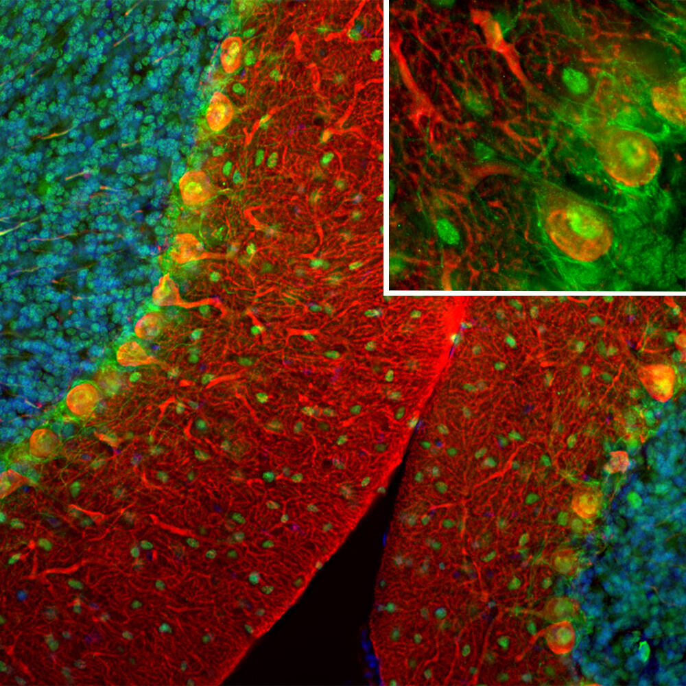 Anti-Secretagogin Antibody