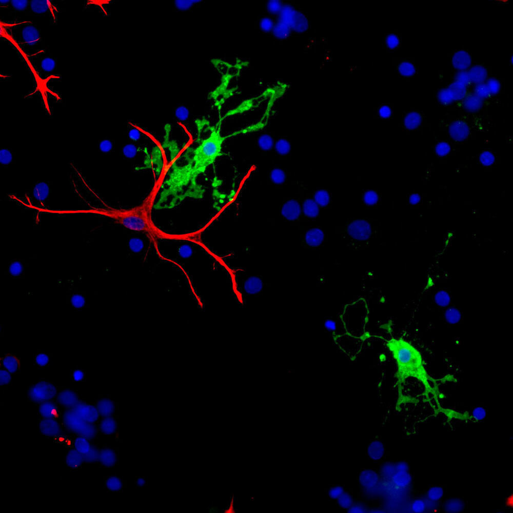 Anti-CNPase Antibody