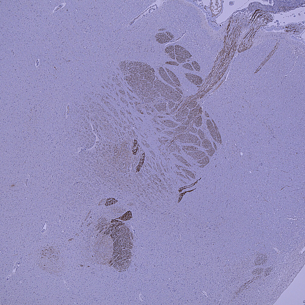 Anti-Peripherin Antibody