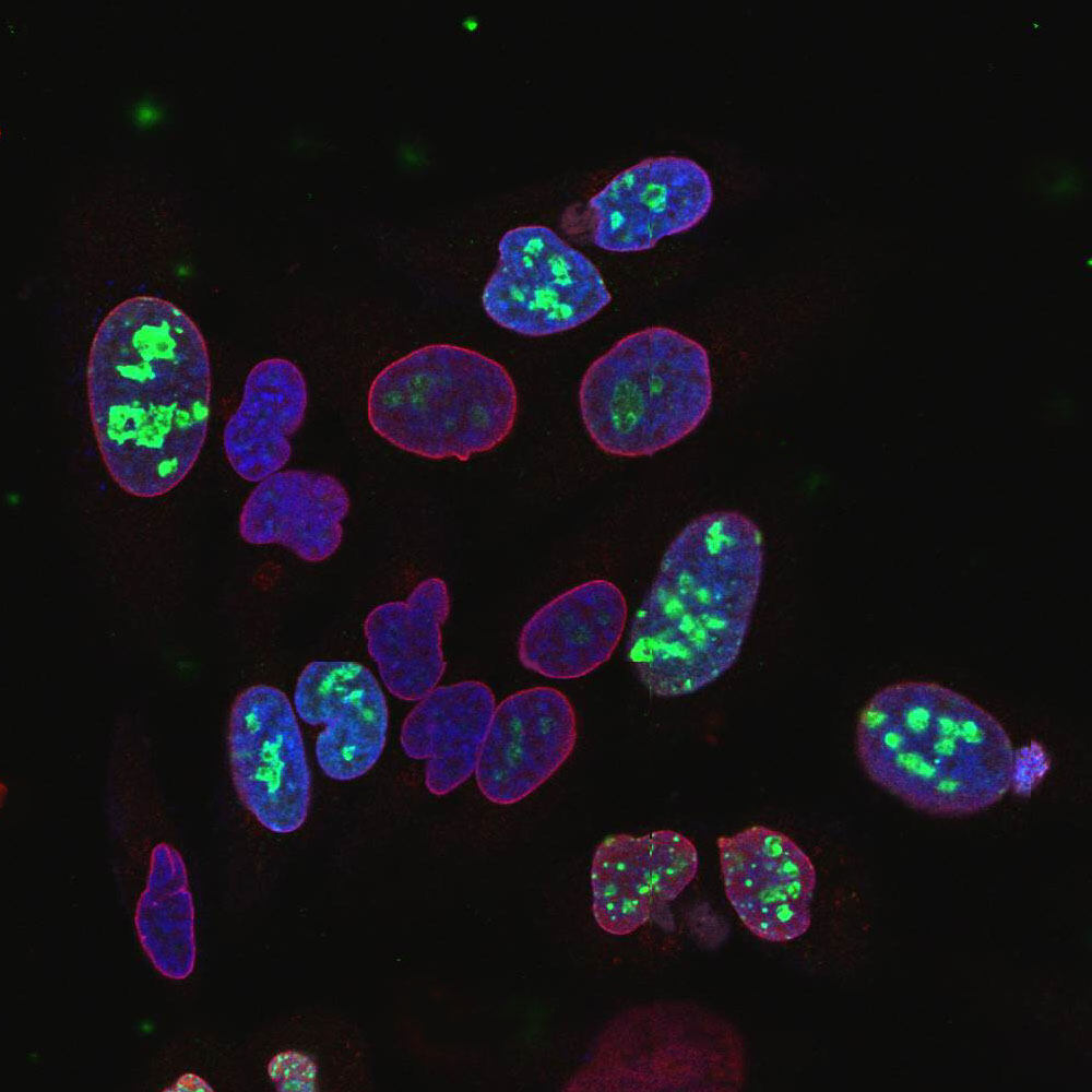 Anti-Lamin A + Lamin C Antibody