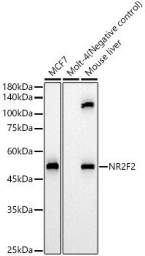 Anti-NR2F2 Antibody, 100 µl