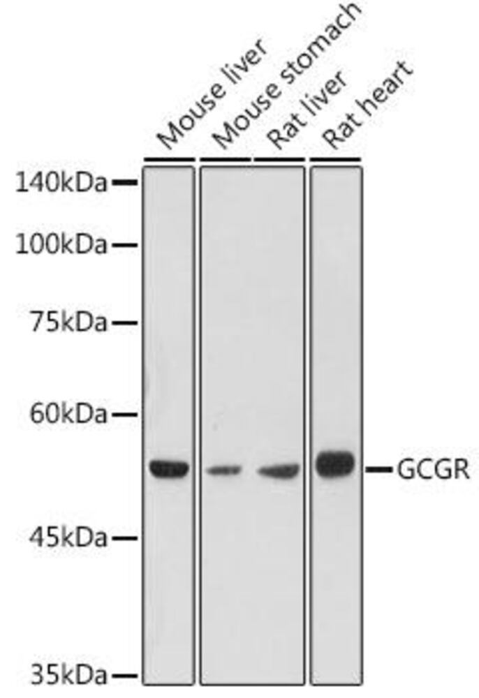 Anti-Glucagon Receptor Antibody, 100 µl