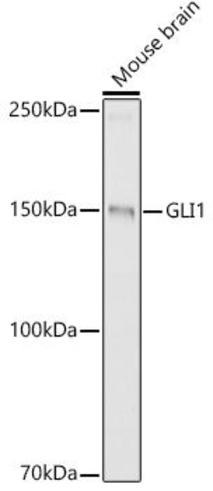 Anti-Gli1 Antibody