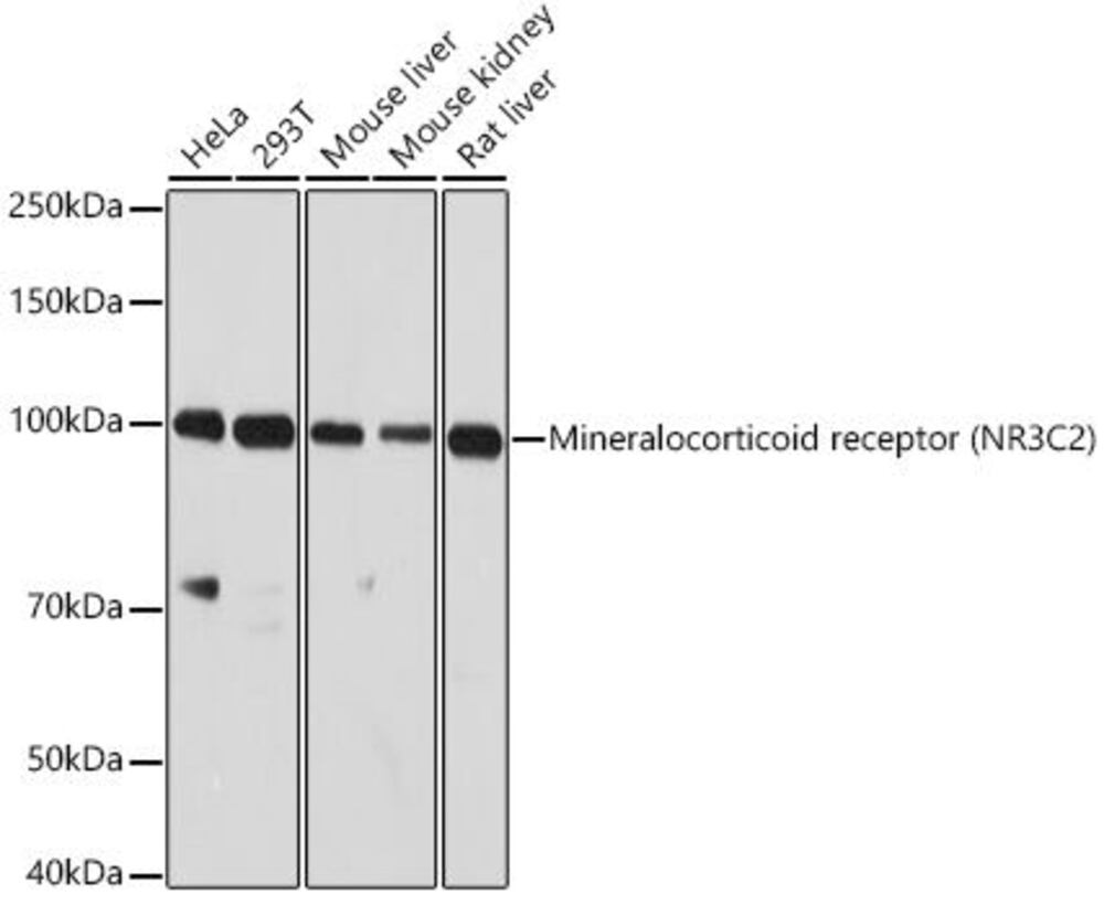 Anti-Mineralocorticoid Receptor Antibody, 100 µl