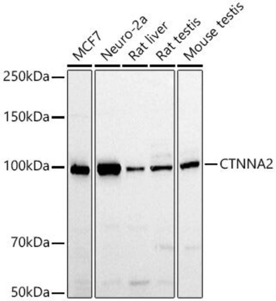 Anti-CTNNA2 Antibody, 100 µl
