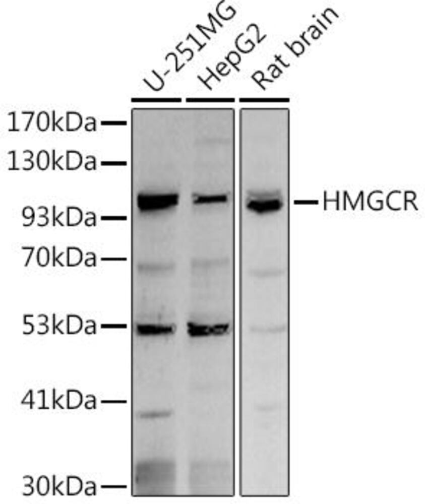 Anti-HMGCR Antibody, 100 µl