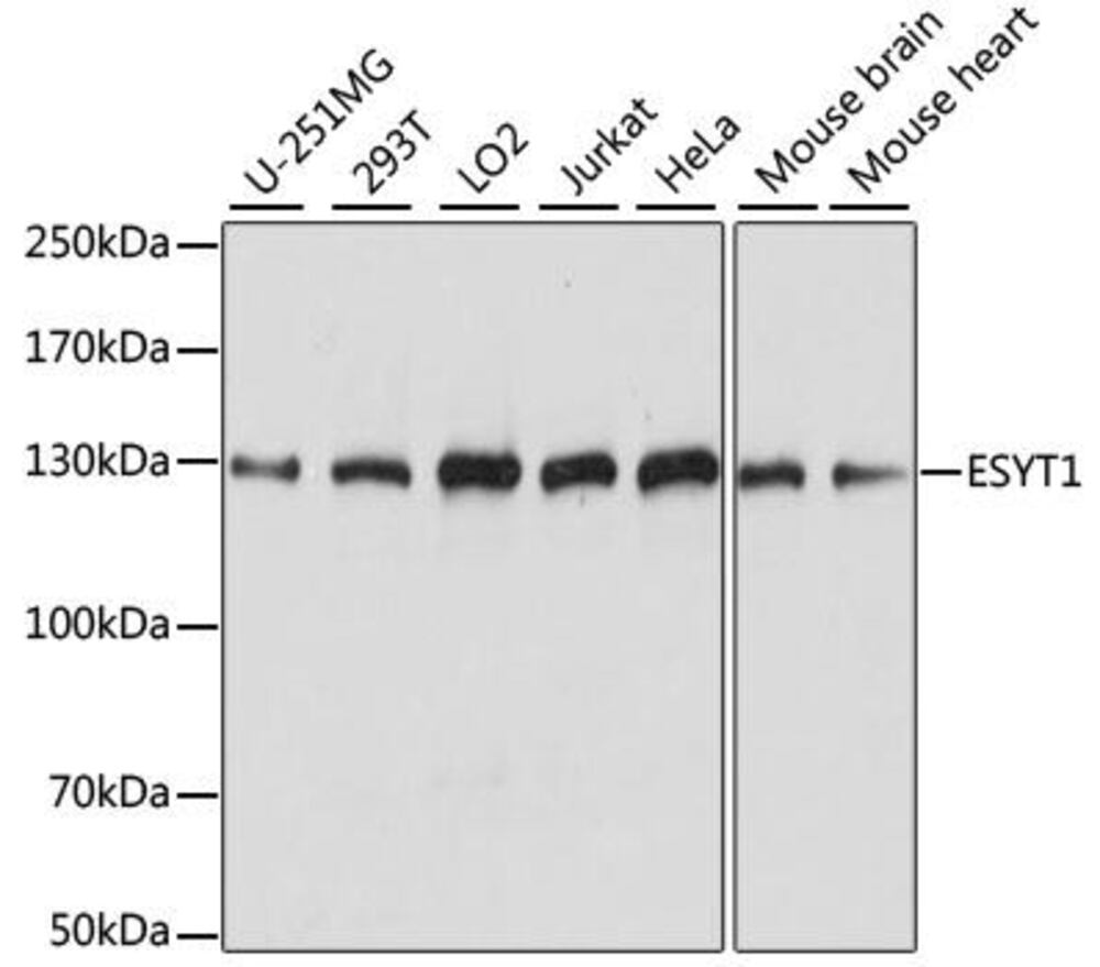 Anti-E-Syt1 Antibody