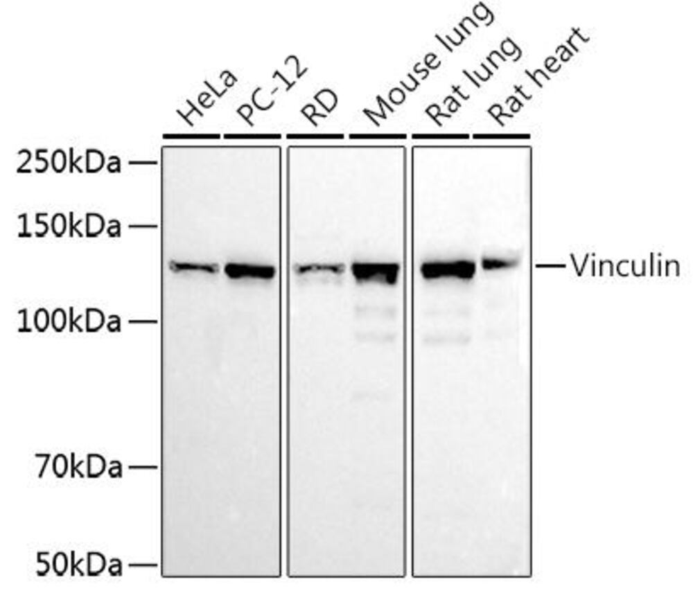 Anti-Vinculin Antibody, 100 µl