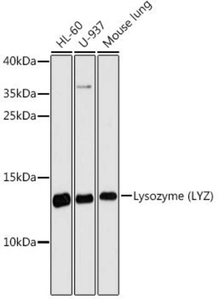Anti-Lysozyme Antibody, 100 µl