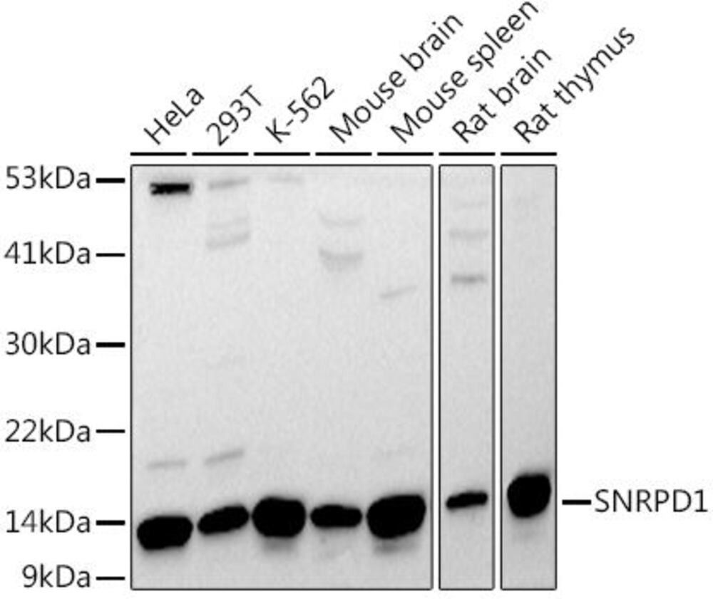 Anti-SNRPD1 Antibody, 100 µl