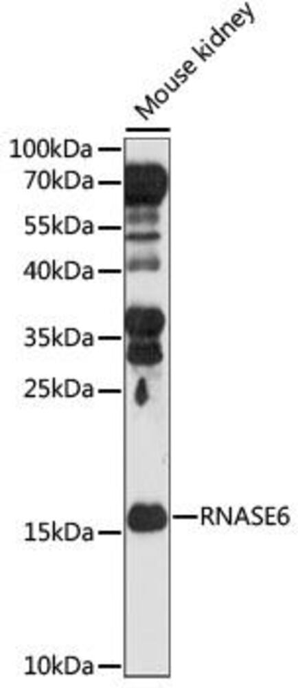 Anti-RNASE6 Antibody, 100 µl