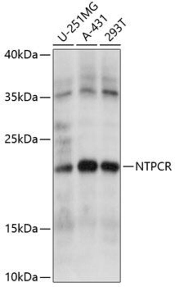 Anti-Nucleoside triphosphate phosphohydrolase Antibody, 100 µl