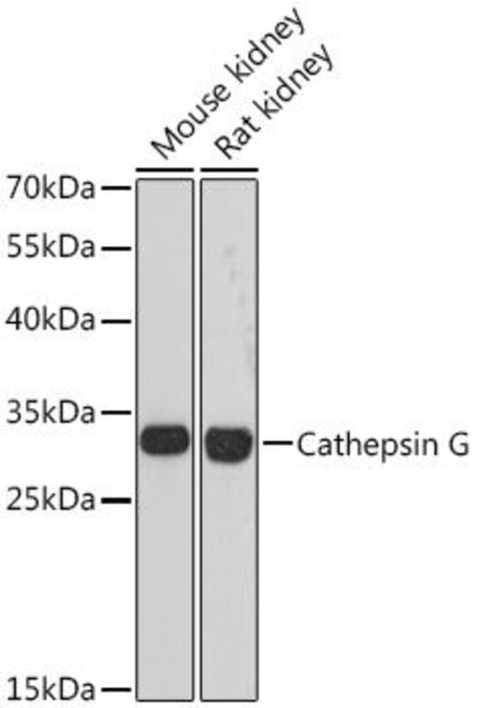 Anti-Cathepsin G Antibody, 100 µl