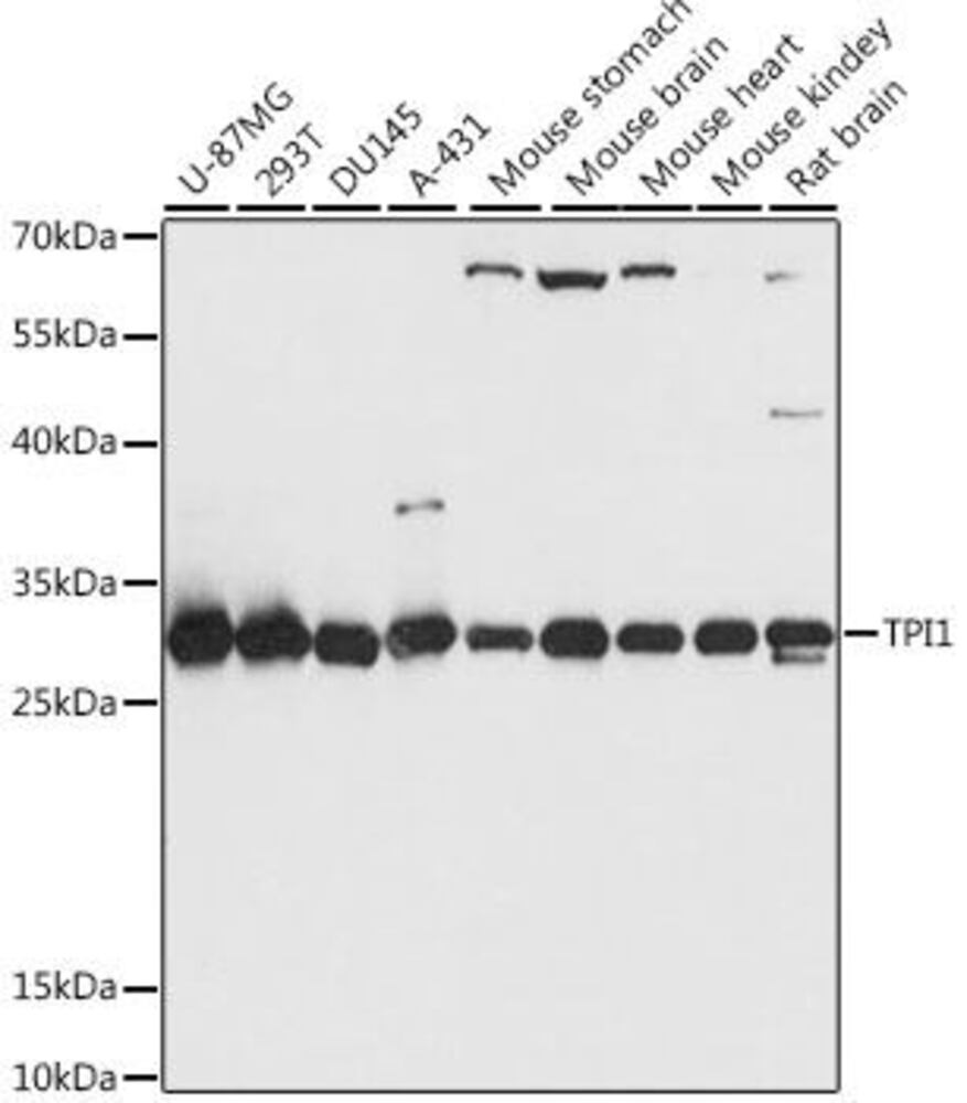 Anti-Triosephosphate isomerase Antibody, 100 µl