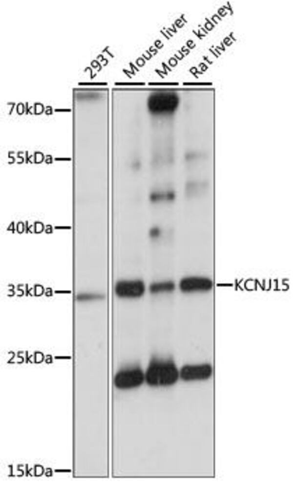 Anti-KCNJ15 Antibody