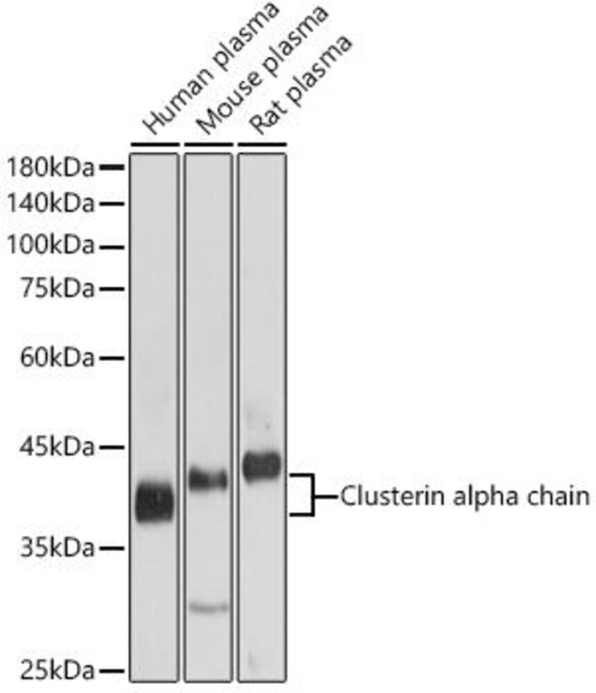Anti-Clusterin Antibody, 100 µl