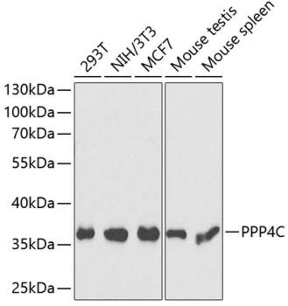 Anti-PP-X Antibody