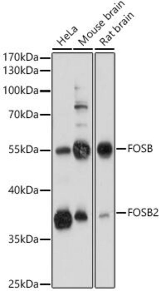 Anti-Fos B Antibody, 100 µl