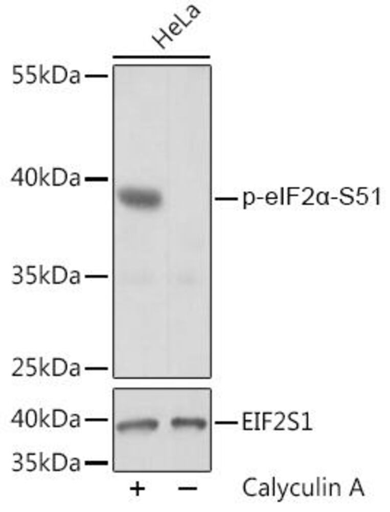 Anti-EIF2S1 (phospho Ser51) Antibody