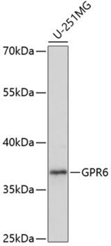 Anti-GPCR GPR6 Antibody, 100 µl