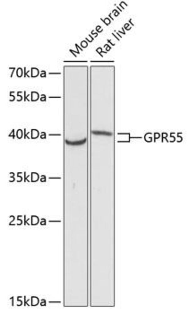 Anti-GPCR GPR55 Antibody, 100 µl